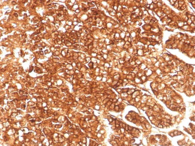 P-glycoprotein/p170/MDR1/CD243 Antibody in Immunohistochemistry (Paraffin) (IHC (P))