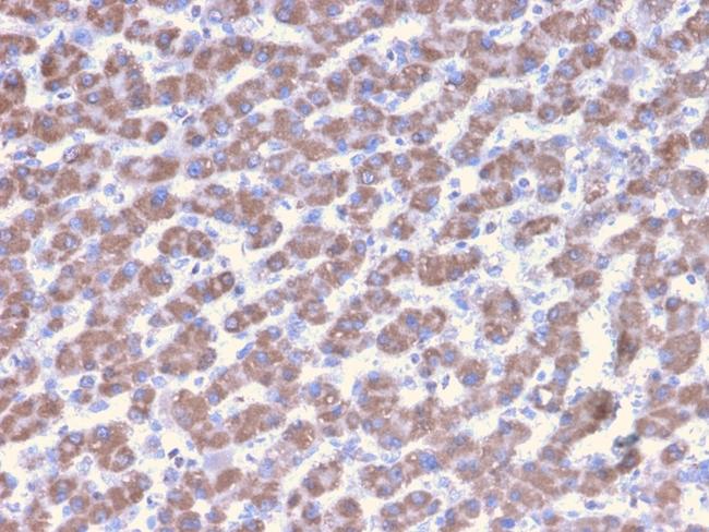 Prohibitin (Mitochondrial Marker) Antibody in Immunohistochemistry (Paraffin) (IHC (P))