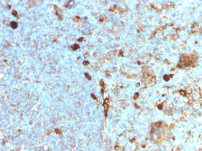 Alpha-1-Antitrypsin (SERPINA1) Antibody in Immunohistochemistry (Paraffin) (IHC (P))