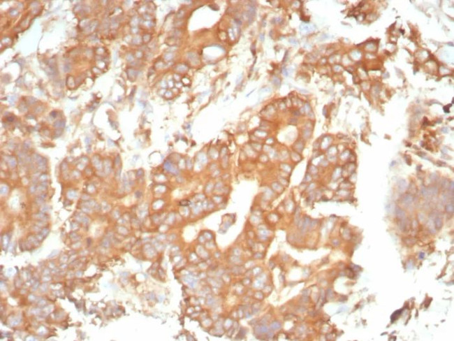 Alpha-1-Antitrypsin (SERPINA1) (Hepatocellular and Histiocytic Marker) Antibody in Immunohistochemistry (Paraffin) (IHC (P))