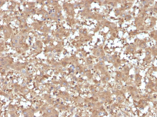 Alpha-1-Antitrypsin (SERPINA1) (Hepatocellular and Histiocytic Marker) Antibody in Immunohistochemistry (Paraffin) (IHC (P))