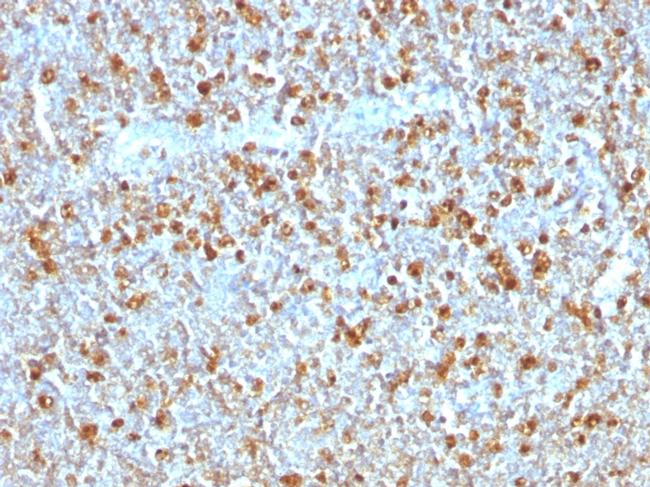 Alpha-1-Antitrypsin (SERPINA1) Antibody in Immunohistochemistry (Paraffin) (IHC (P))