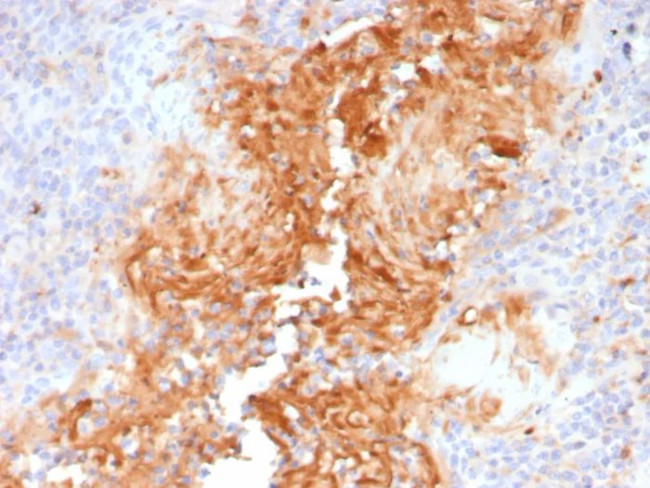 Alpha-1-Antitrypsin (SERPINA1) (Hepatocellular and Histiocytic Marker) Antibody in Immunohistochemistry (Paraffin) (IHC (P))