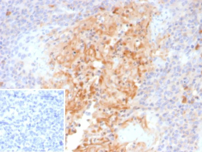 Alpha-1-Antitrypsin (SERPINA1) (Hepatocellular and Histiocytic Marker) Antibody in Immunohistochemistry (Paraffin) (IHC (P))