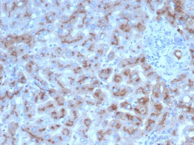 Alpha-1-Antitrypsin (SERPINA1) (Hepatocellular and Histiocytic Marker) Antibody in Immunohistochemistry (Paraffin) (IHC (P))