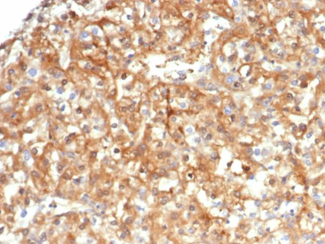 Alpha-1-Antitrypsin (SERPINA1) (Hepatocellular and Histiocytic Marker) Antibody in Immunohistochemistry (Paraffin) (IHC (P))