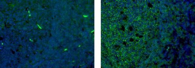 CD19 Antibody in Immunohistochemistry (Paraffin) (IHC (P))