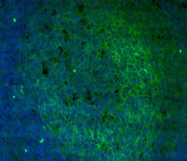 CD11b Antibody in Immunohistochemistry (Paraffin) (IHC (P))