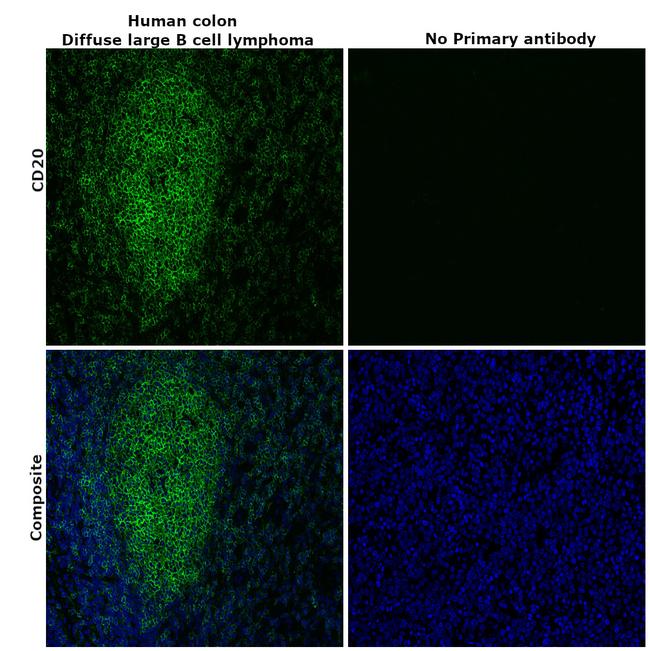 CD20 Antibody in Immunohistochemistry (Paraffin) (IHC (P))