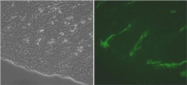 LYVE1 Antibody in Immunohistochemistry (Frozen) (IHC (F))