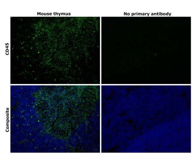 CD45 Antibody in Immunohistochemistry (Paraffin) (IHC (P))