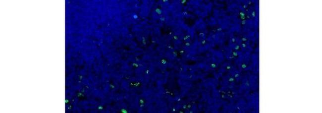 AIRE Antibody in Immunohistochemistry (Frozen) (IHC (F))