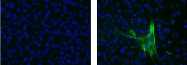 Actin (muscle) Antibody in Immunocytochemistry (ICC/IF)