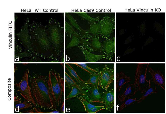 Vinculin Antibody in Immunocytochemistry (ICC/IF)