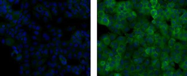 Snail1 Antibody in Immunocytochemistry (ICC/IF)