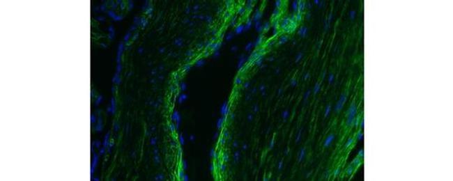 Collagen IV Antibody in Immunohistochemistry (Paraffin) (IHC (P))