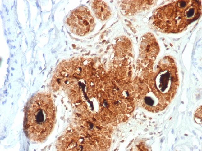 GCDFP-15 (Gross Cystic Disease Fluid Protein 15) (Breast Marker) Antibody in Immunohistochemistry (Paraffin) (IHC (P))