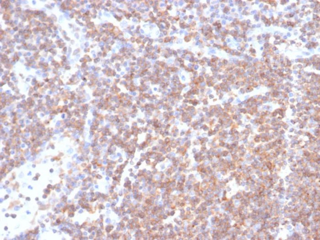 PLK1 Antibody in Immunohistochemistry (Paraffin) (IHC (P))