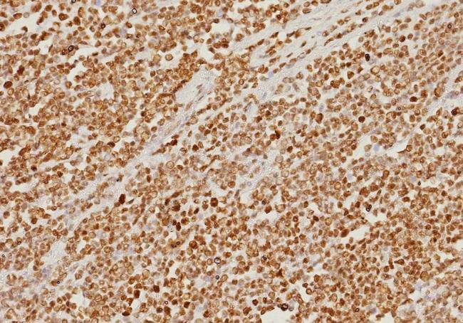 PMS2 (Postmeiotic Segregation Increased 2) Antibody in Immunohistochemistry (Paraffin) (IHC (P))