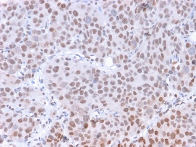 Phospho-RNA Polymerase II CTD Repeat YSPTSPS (Ser5) Antibody in Immunohistochemistry (Paraffin) (IHC (P))