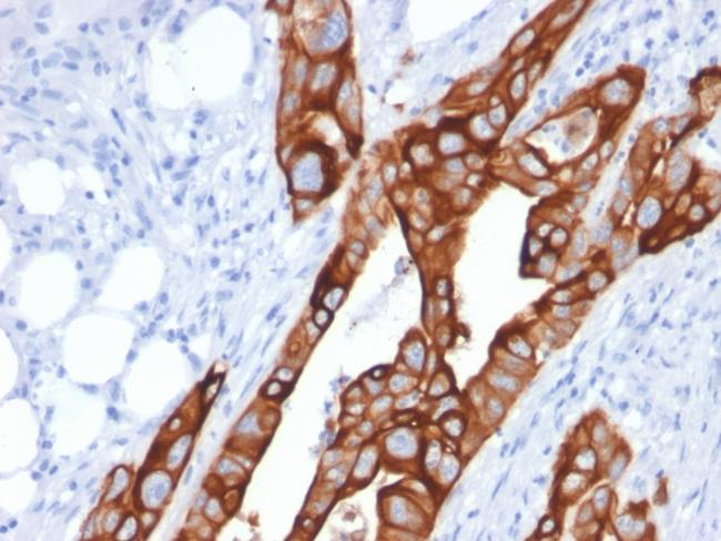 Cytokeratin 20 (KRT20) (Colorectal Epithelial Marker) Antibody in Immunohistochemistry (Paraffin) (IHC (P))