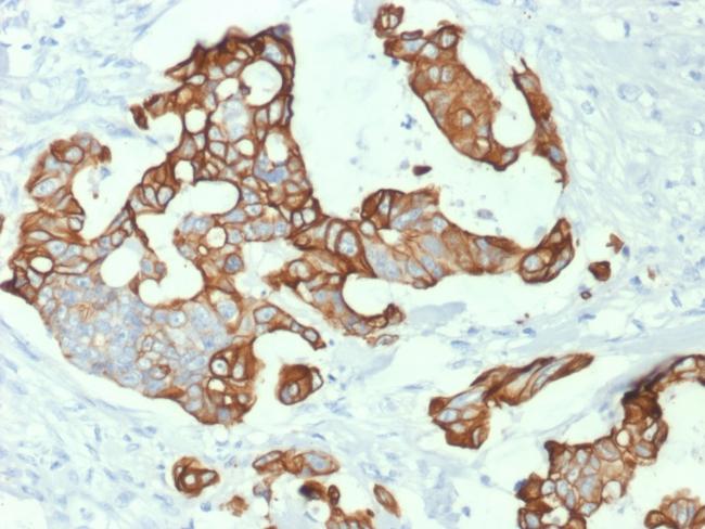 Cytokeratin 20 (KRT20) (Colorectal Epithelial Marker) Antibody in Immunohistochemistry (Paraffin) (IHC (P))