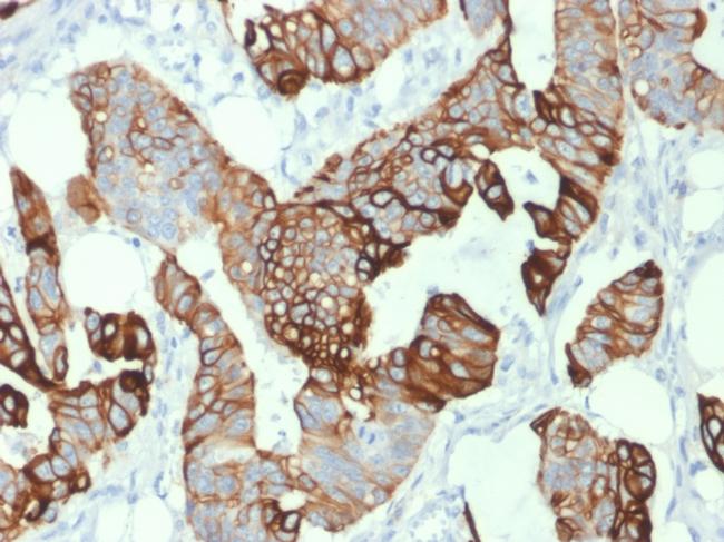 Cytokeratin 20 (KRT20) Antibody in Immunohistochemistry (Paraffin) (IHC (P))