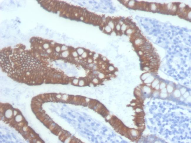 Cytokeratin 20 (KRT20) (Colorectal Epithelial Marker) Antibody in Immunohistochemistry (Paraffin) (IHC (P))