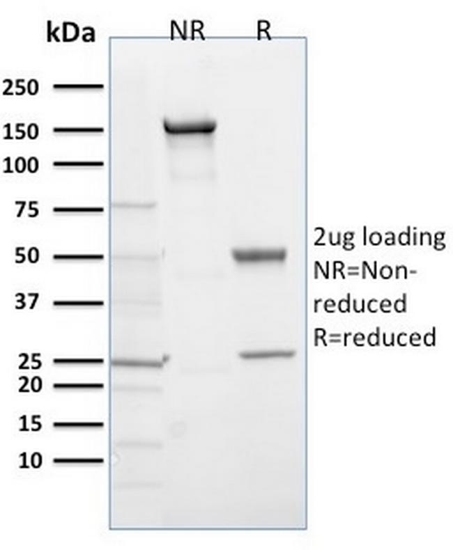 EGLN1/PHD2 Antibody in SDS-PAGE (SDS-PAGE)