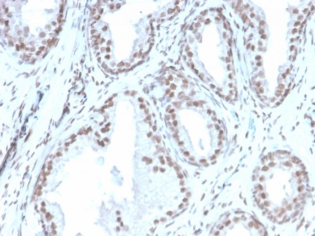 ATRX/RAD54 (Alpha Thalassemia Mental Retardation) Antibody in Immunohistochemistry (Paraffin) (IHC (P))