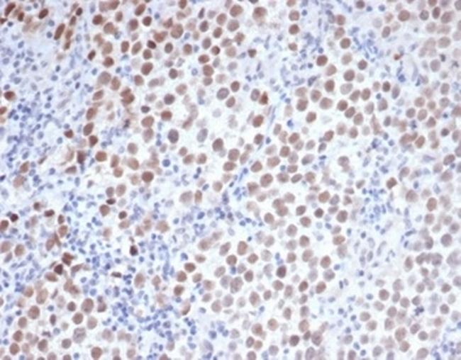 OCT-4 (POU5F1) (Germ Cell Tumor Marker) Antibody in Immunohistochemistry (Paraffin) (IHC (P))