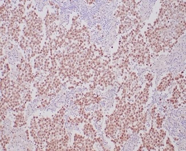 OCT-4 (POU5F1) (Germ Cell Tumor Marker) Antibody in Immunohistochemistry (Paraffin) (IHC (P))