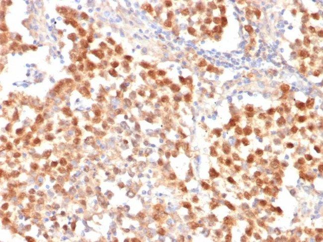 OCT-4 (POU5F1) (Germ Cell Tumor Marker) Antibody in Immunohistochemistry (Paraffin) (IHC (P))