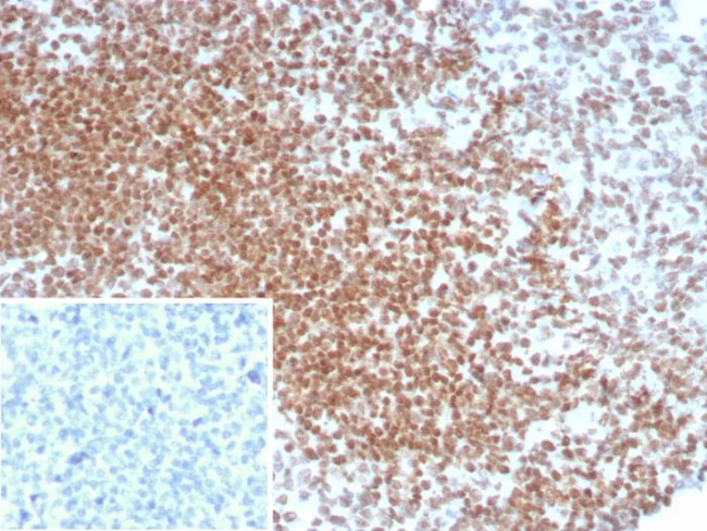 OCT-4 (POU5F1) (Germ Cell Tumor Marker) Antibody in Immunohistochemistry (Paraffin) (IHC (P))