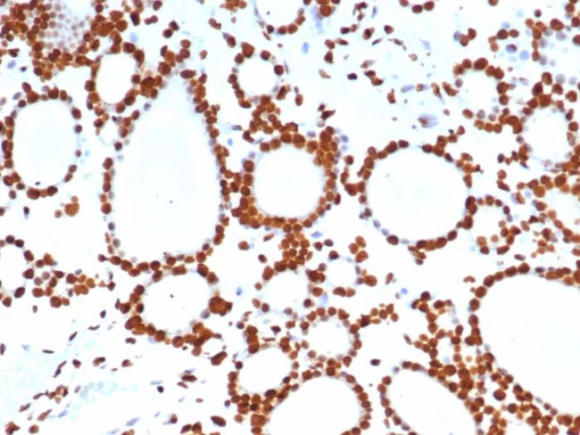 PET1/FEV Antibody in Immunohistochemistry (Paraffin) (IHC (P))