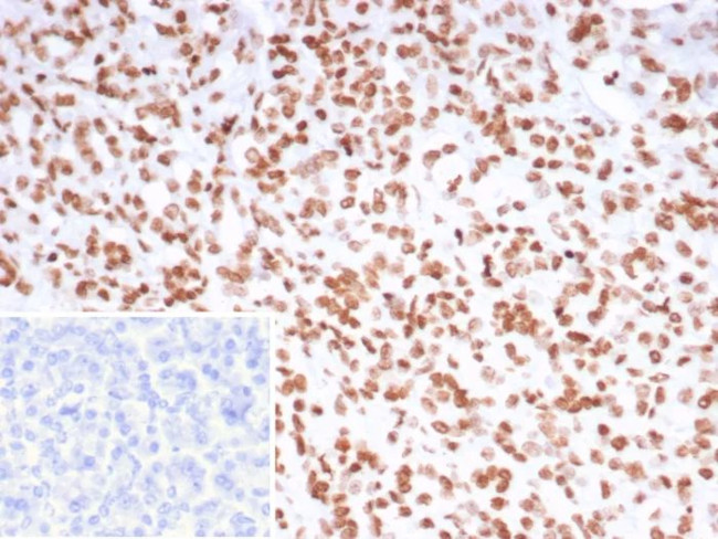 PET1/FEV Antibody in Immunohistochemistry (Paraffin) (IHC (P))