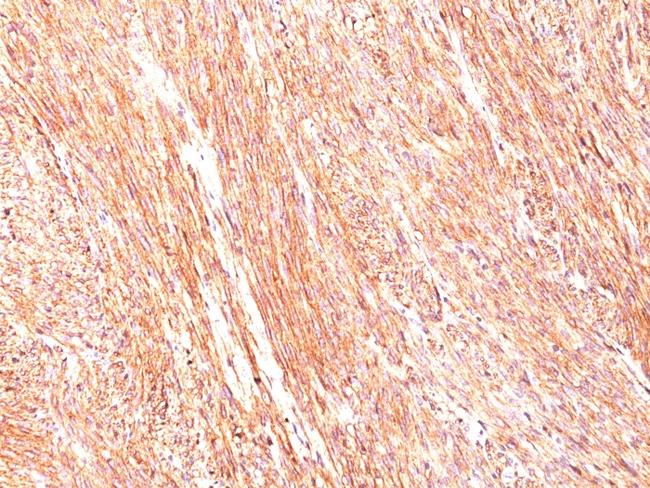 DOG-1/TMEM16A (Gastrointestinal Stromal Tumor Marker) Antibody in Immunohistochemistry (Paraffin) (IHC (P))