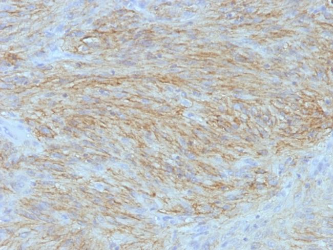 DOG-1/ANO1 (Marker for Gastrointestinal Stromal Tumors) Antibody in Immunohistochemistry (Paraffin) (IHC (P))