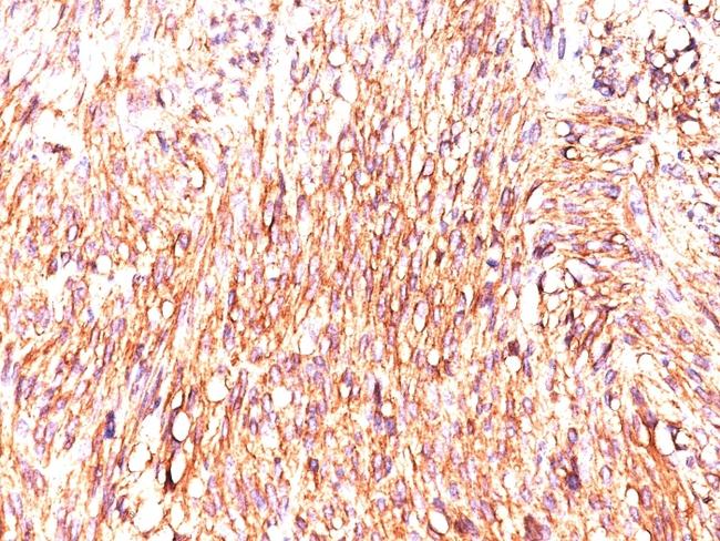 DOG-1/TMEM16A (Marker for Gastrointestinal Stromal Tumors) Antibody in Immunohistochemistry (Paraffin) (IHC (P))