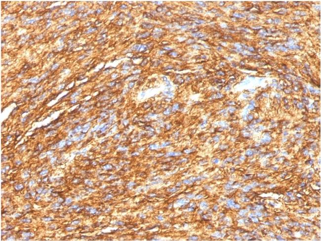 DOG-1/TMEM16A Antibody in Immunohistochemistry (Paraffin) (IHC (P))