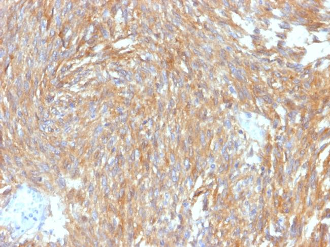 DOG-1/TMEM16A Antibody in Immunohistochemistry (Paraffin) (IHC (P))