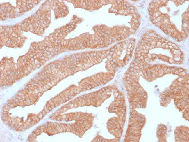 Calcineurin A/PPP3CA Antibody in Immunohistochemistry (Paraffin) (IHC (P))