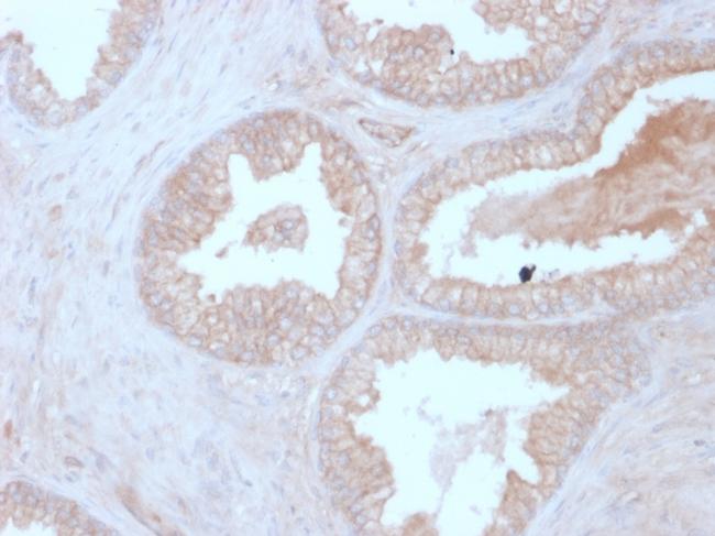 Calcineurin B/PPP3R1 Antibody in Immunohistochemistry (Paraffin) (IHC (P))