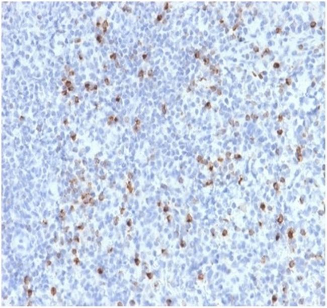 Perforin-1 (Pore Forming Protein) (Apoptosis Marker) Antibody in Immunohistochemistry (Paraffin) (IHC (P))