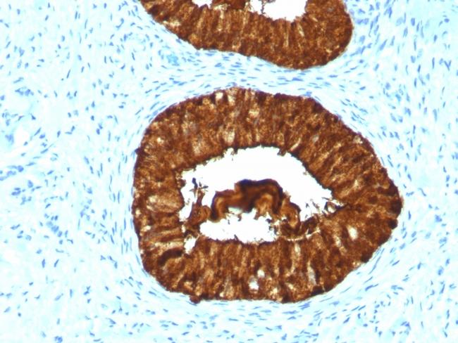 MAML3 (Mastermind Like Transcriptional Coactivator 3) Antibody in Immunohistochemistry (Paraffin) (IHC (P))