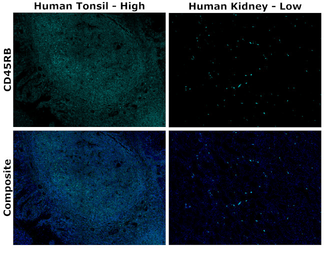 CD45RB Antibody in Immunohistochemistry (Paraffin) (IHC (P))