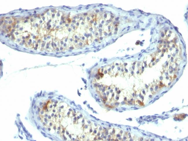 Prolactin Receptor (hPRL Receptor) Antibody in Immunohistochemistry (Paraffin) (IHC (P))