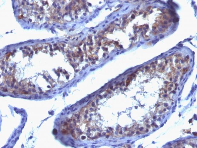 Prolactin Receptor (PRL-R) Antibody in Immunohistochemistry (Paraffin) (IHC (P))