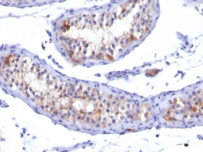 Prolactin Receptor (hPRL Receptor) Antibody in Immunohistochemistry (Paraffin) (IHC (P))