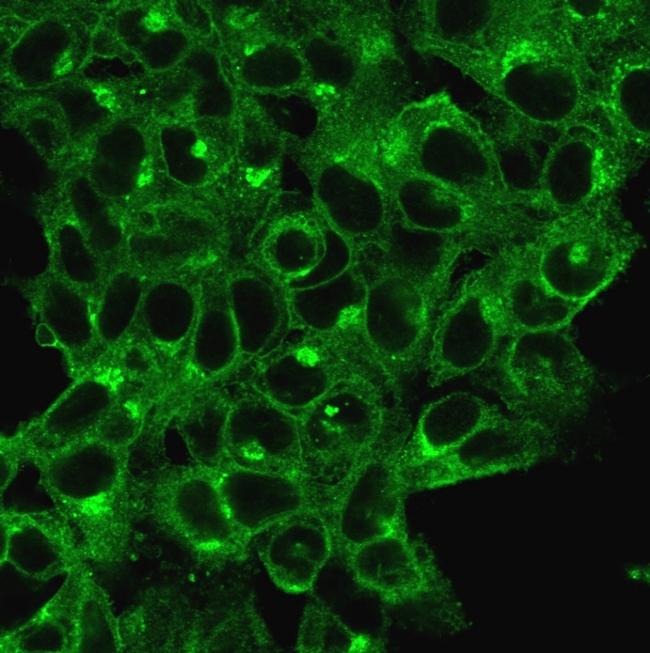 Beta-2 Microglobulin Antibody in Immunocytochemistry (ICC/IF)